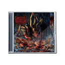 Umbilical Asphyxia "Rampant Infantile Strangulation" CD